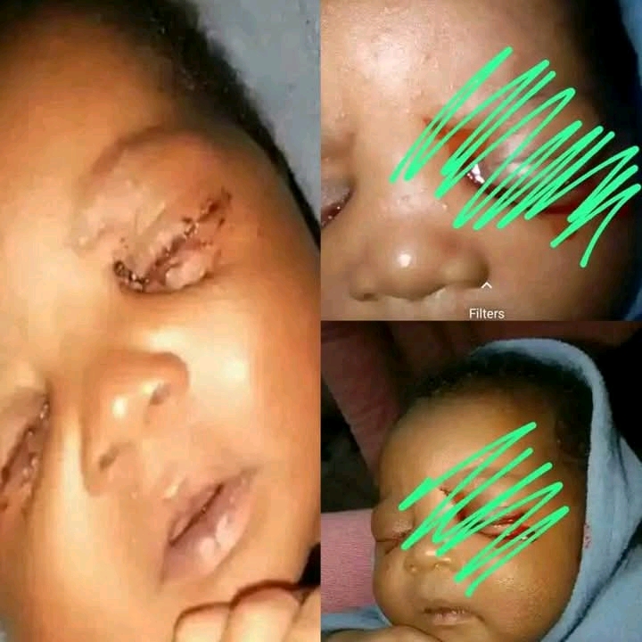 Mother Pleads for Urgent Help as 2-Month-Old Baby Cries Blood